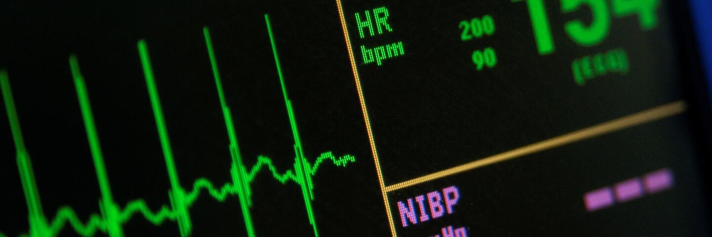 heart monitor