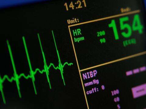 heart monitor