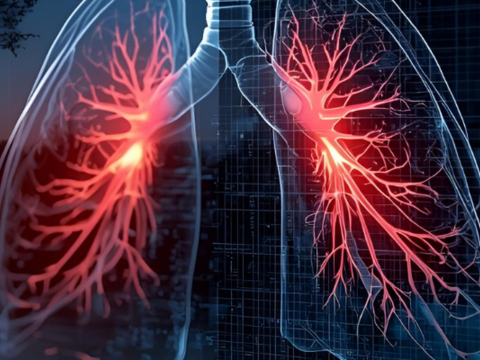 lung nodule story